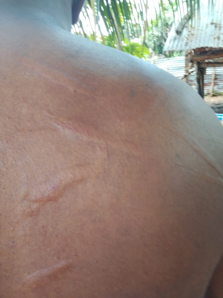 Tamil activist was attacked 